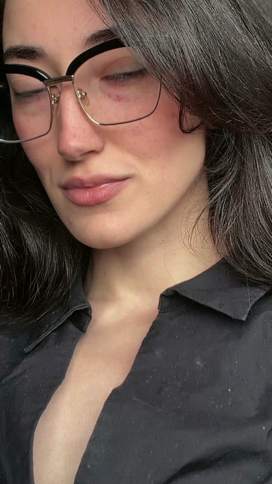 Post 1 by Aruc.g on TikTok (video)