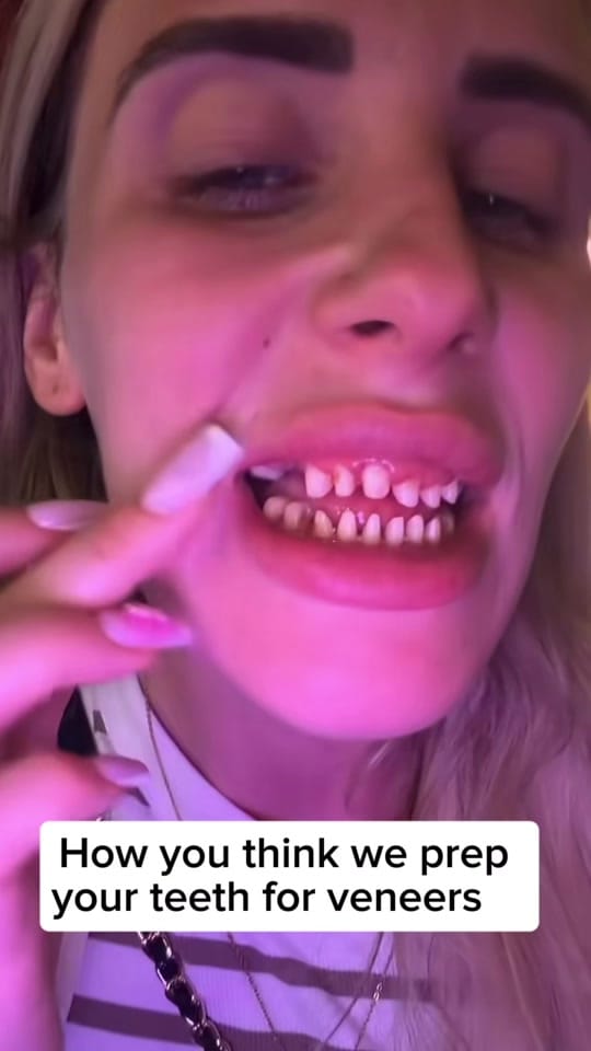 Post 4 by Smilesbydrp on TikTok (video)