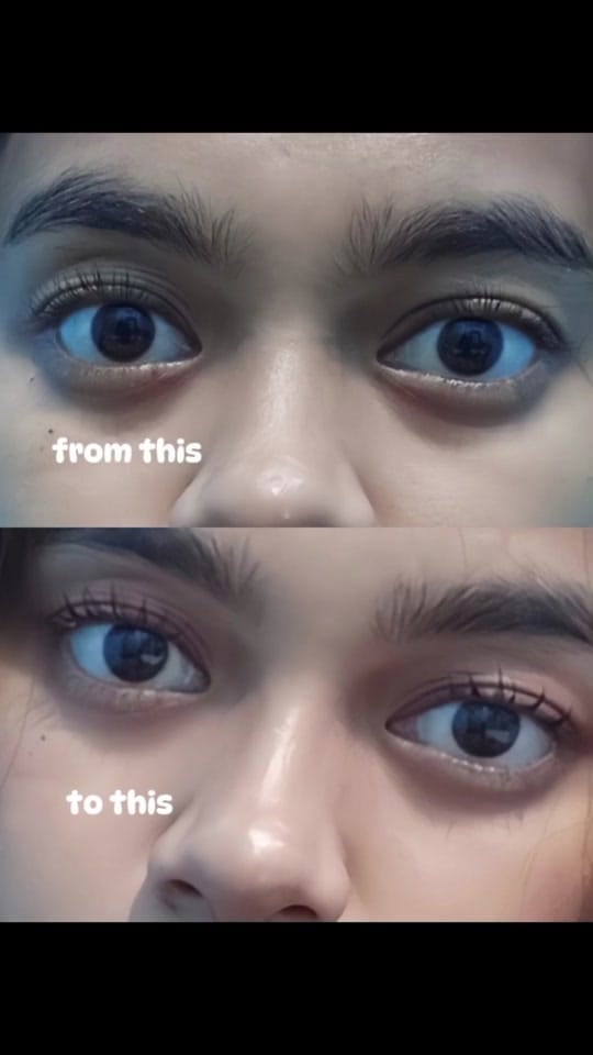 Post 9 by aralcyu on TikTok (video)