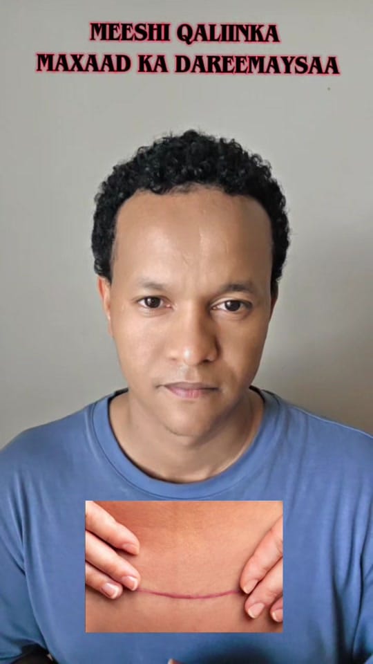 Post 6 by Dr Isak on TikTok (video)