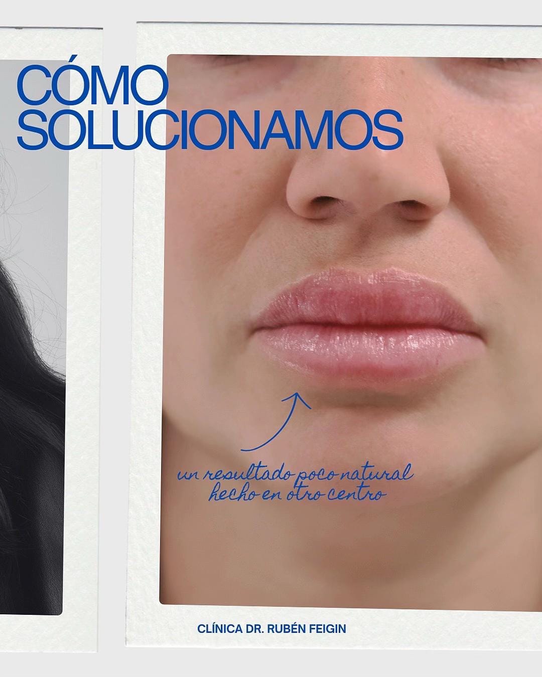 Post 9 by Clínica Estética Rubén Feigin on TikTok (video)