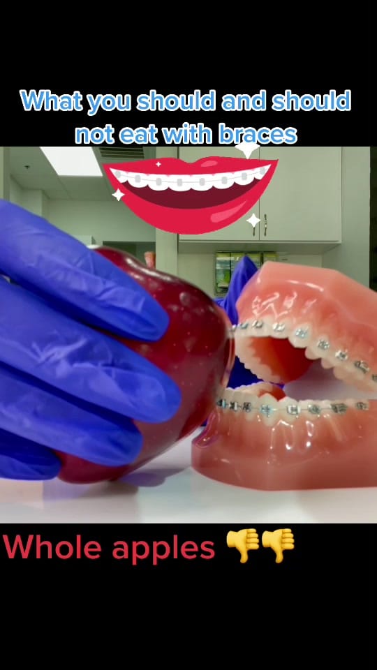 Post 10 by opdsmiles on TikTok (video)