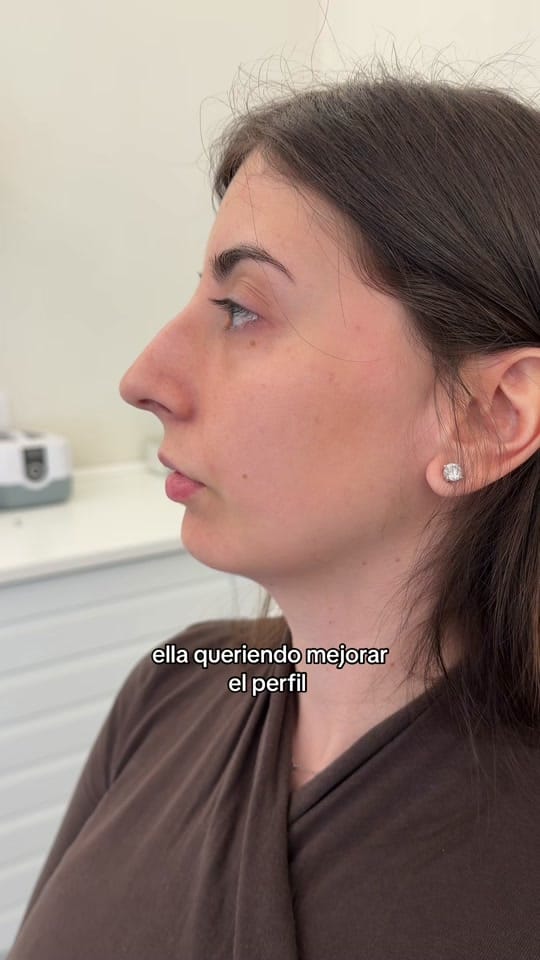Post 3 by Barbaraaestheticc on TikTok (video)