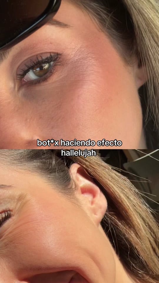 Post 2 by Barbaraaestheticc on TikTok (video)