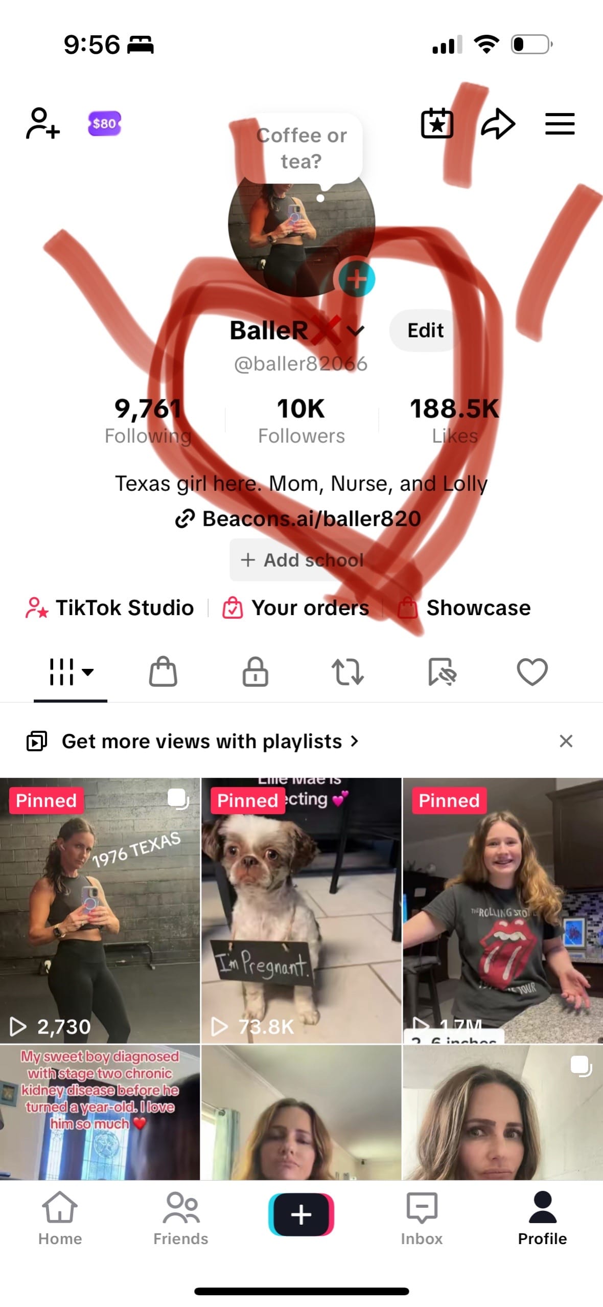 Post 7 by BalleR❌ on TikTok (video)