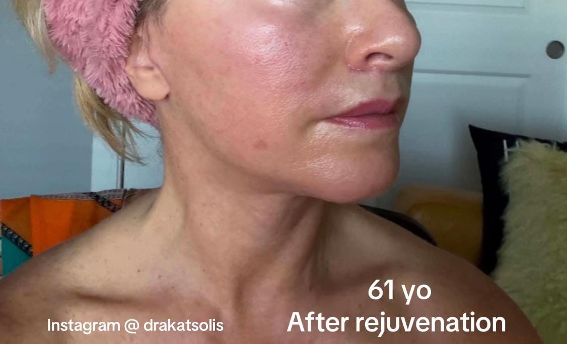 Post 9 by Dra Kat Solís / Facial surgery on TikTok (video)