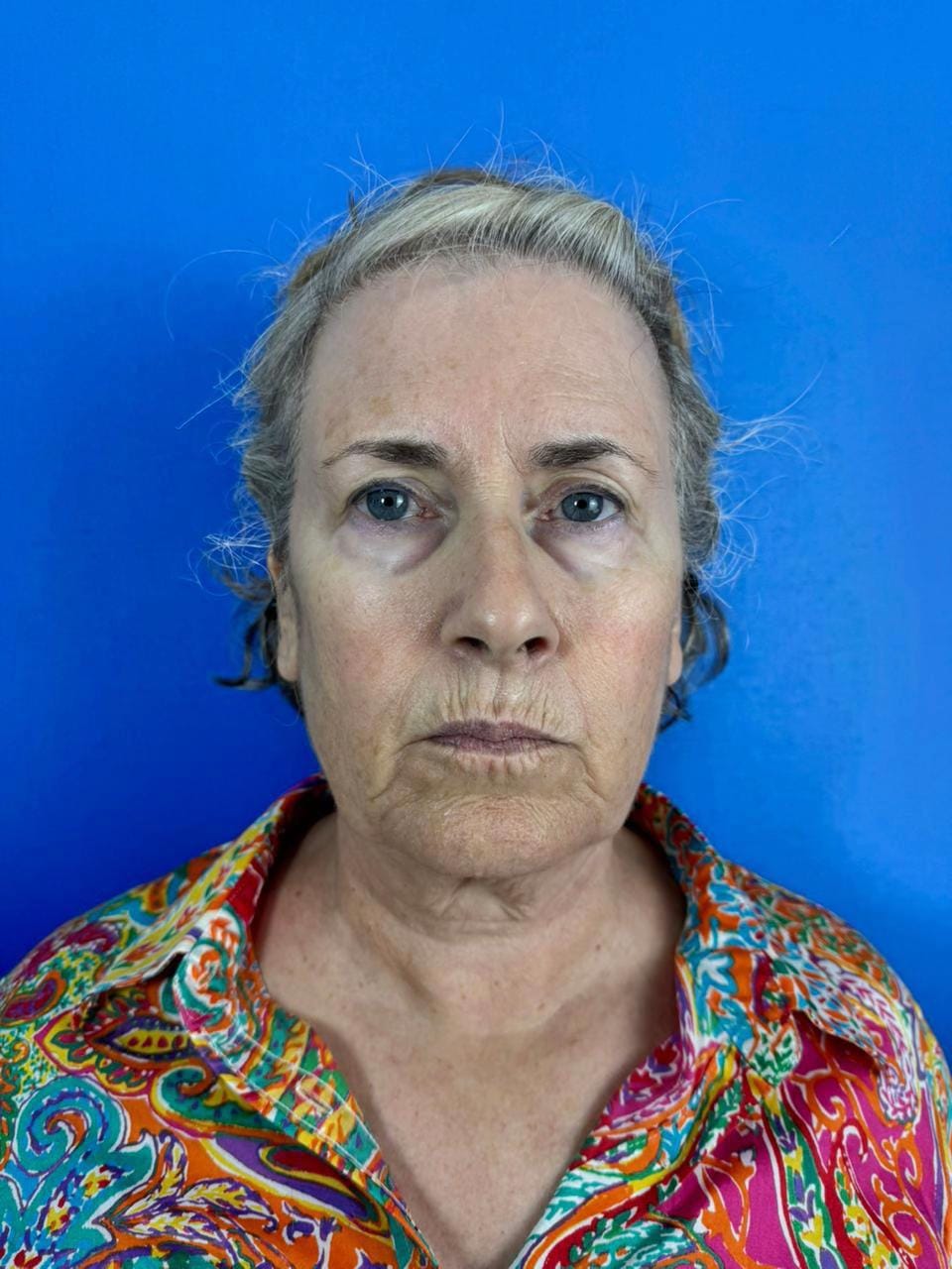 Post 5 by Dra Kat Solís / Facial surgery on TikTok (video)