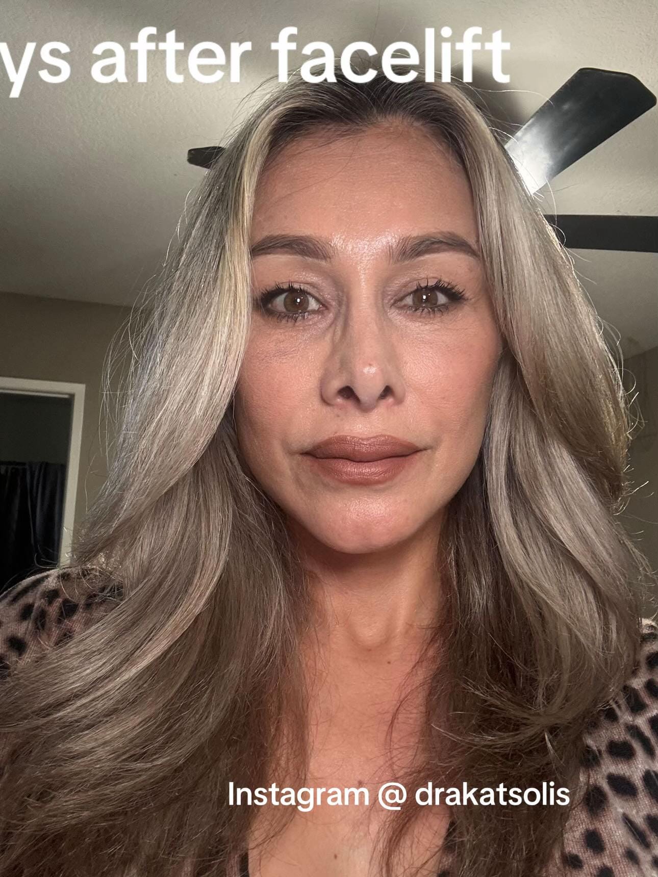Post 10 by Dra Kat Solís / Facial surgery on TikTok (video)