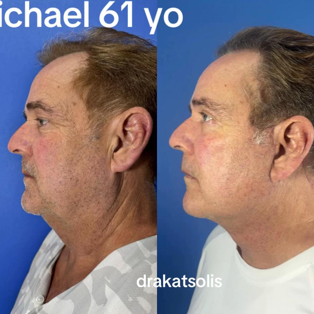 Post 7 by Dra Kat Solís / Facial surgery on TikTok (video)