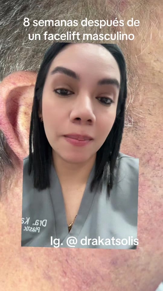 Post 8 by Dra Kat Solís / Facial surgery on TikTok (video)