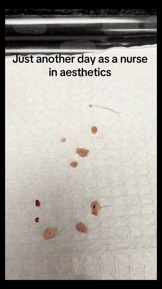 Post 1 by Nurse Angela on TikTok (video)