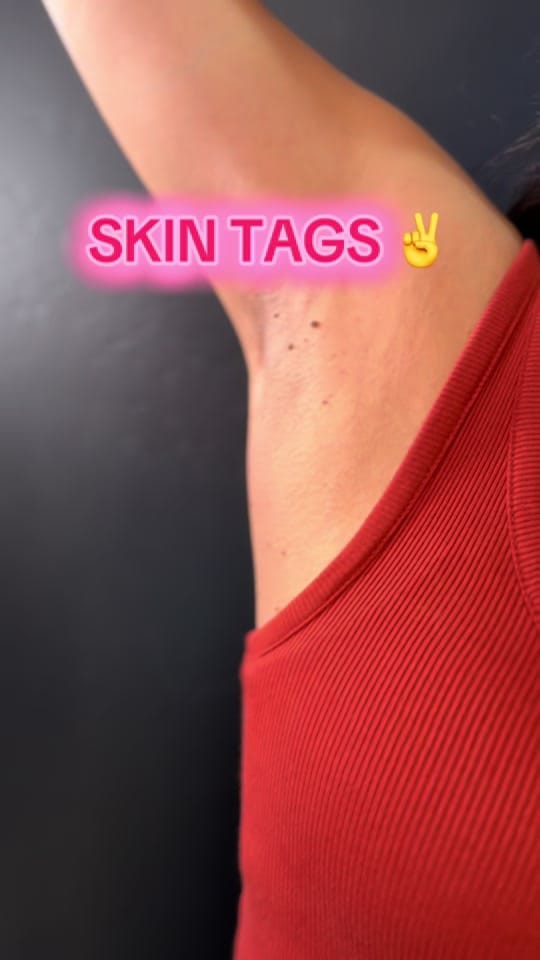 Post 8 by Nurse Angela on TikTok (video)