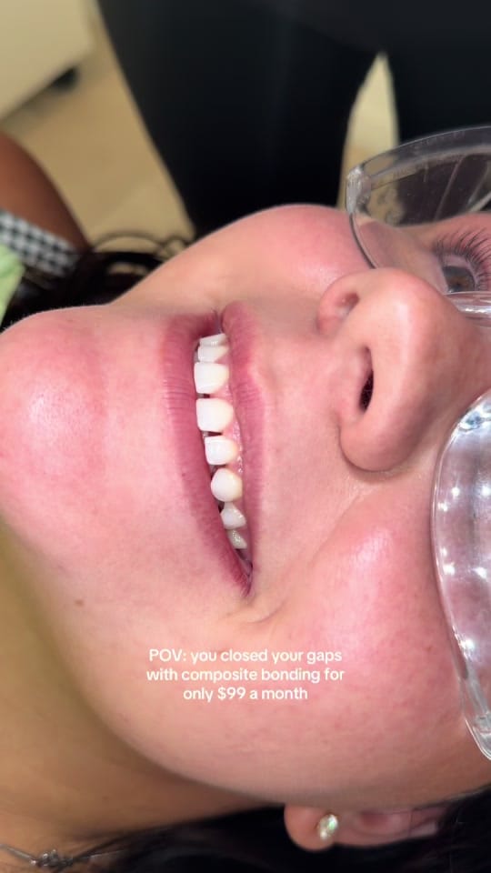 Post 9 by One Smile Aesthetics on TikTok (video)