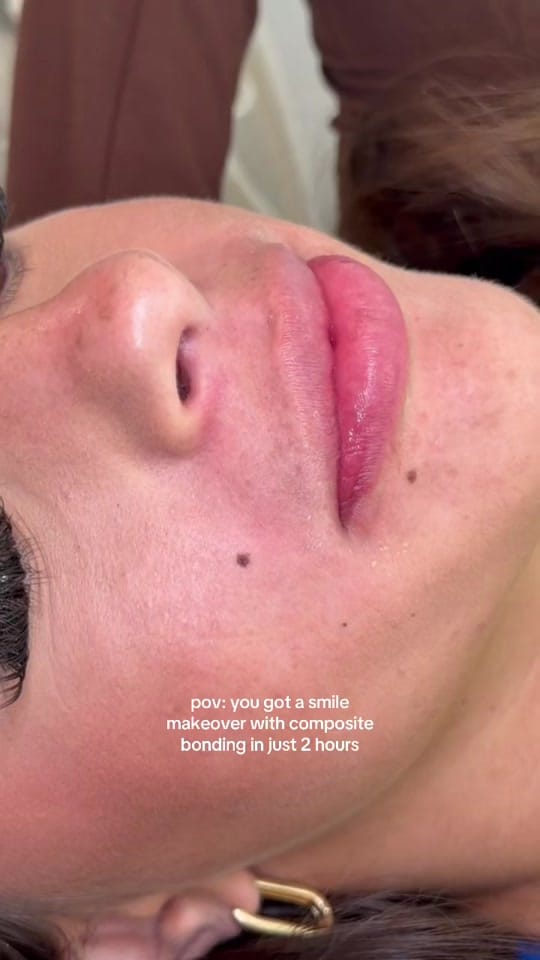 Post 10 by One Smile Aesthetics on TikTok (video)