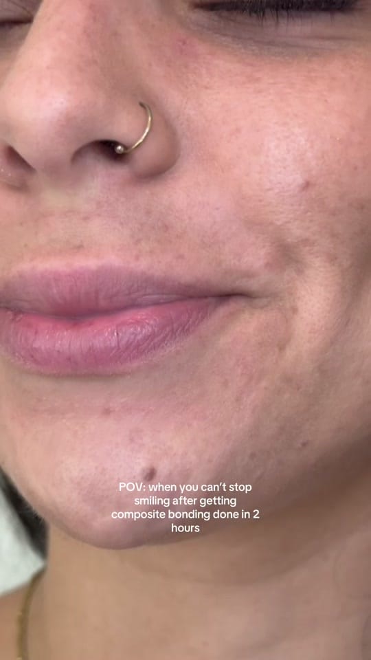 Post 7 by One Smile Aesthetics on TikTok (video)