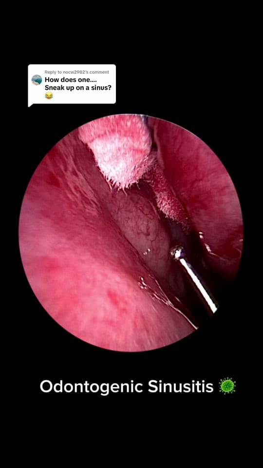 Post 1 by Drbreathebetternow on TikTok (video)
