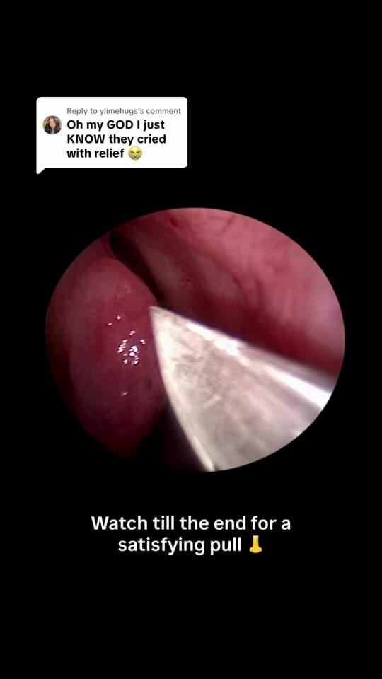 Post 8 by Drbreathebetternow on TikTok (video)