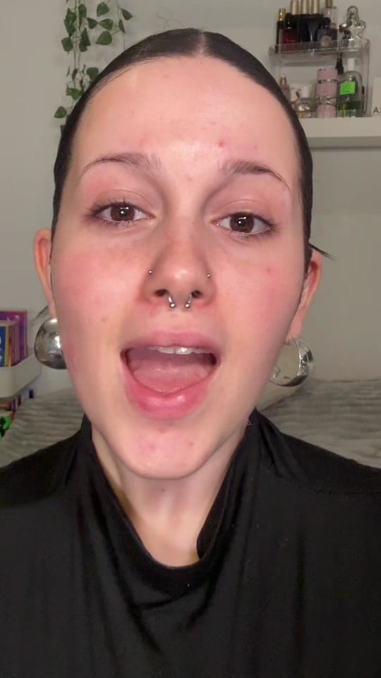 Post 2 by shei on TikTok (video)