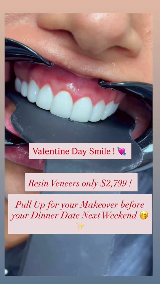 Post 4 by BILLION DOLLAR SMILE on TikTok (video)