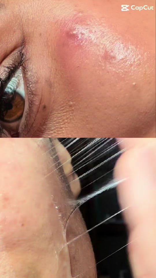 Post 4 by victoriasv13skincare on TikTok (video)