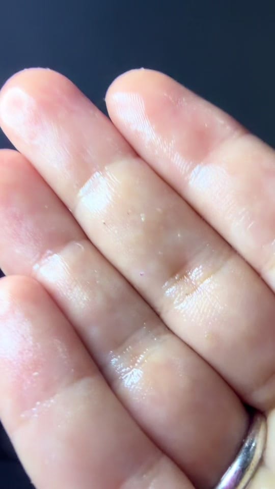 Post 8 by victoriasv13skincare on TikTok (video)