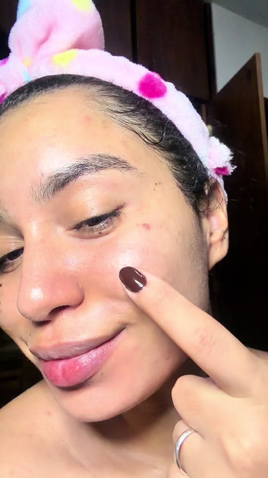 Post 7 by victoriasv13skincare on TikTok (video)