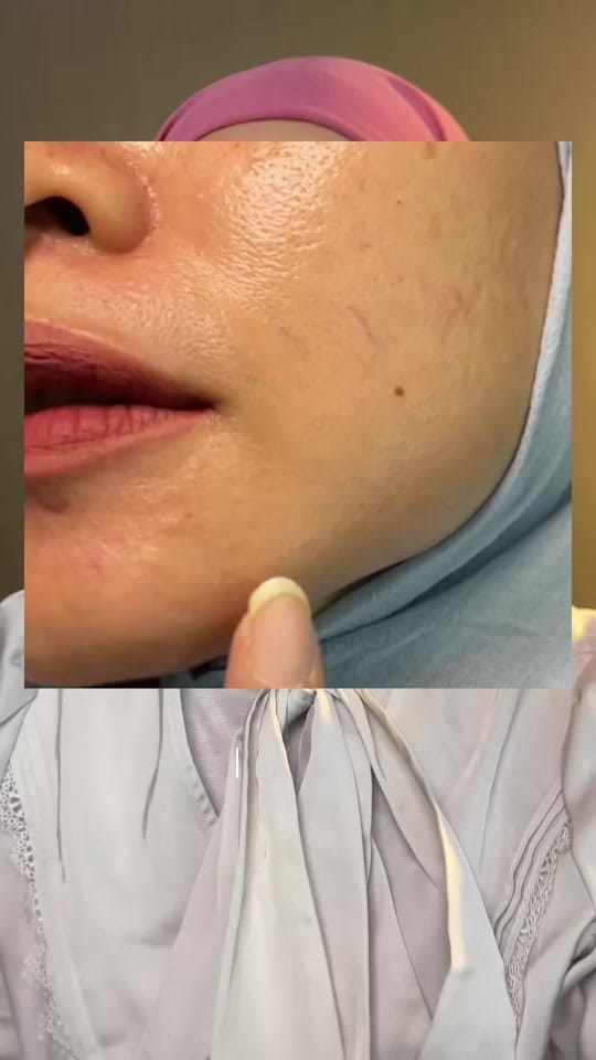 Post 4 by rima_amorfati on TikTok (video)