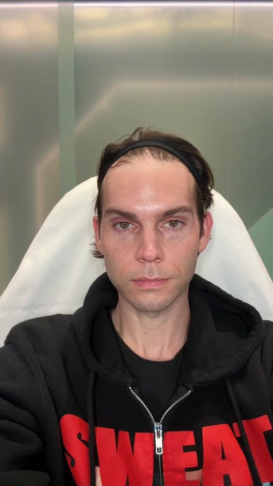 Post 10 by Jason Emer, MD👨‍⚕️ on TikTok (video)