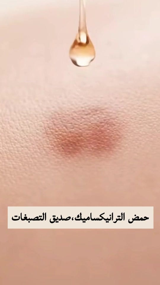 Post 3 by Dr.Amal Hubail on TikTok (video)