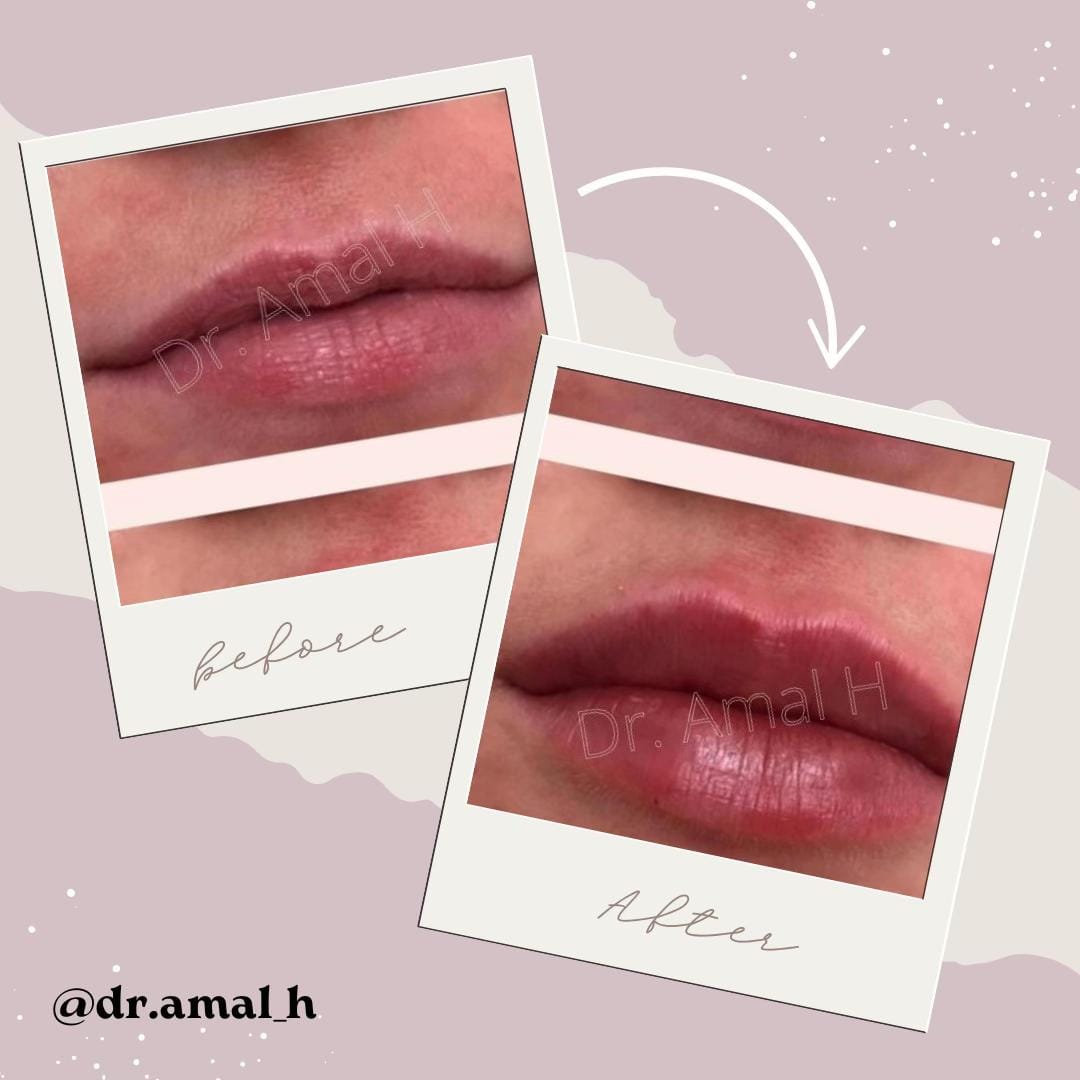 Post 5 by Dr.Amal Hubail on TikTok (video)