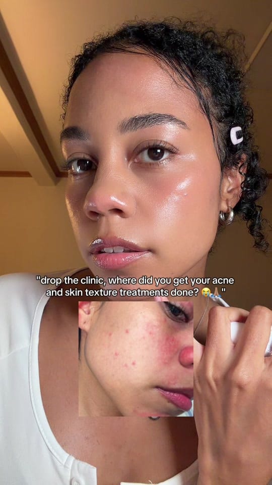 Post 9 by miki ݁˖⋆. on TikTok (video)
