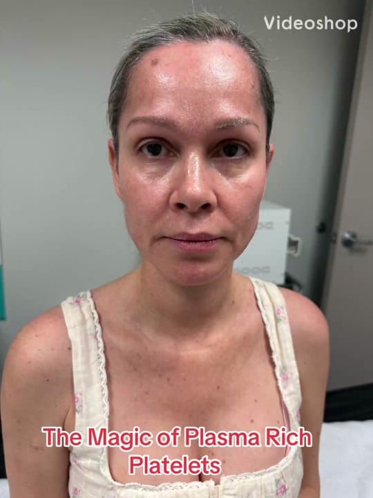 Post 4 by Isabella Mia Skin Care Houston on TikTok (video)