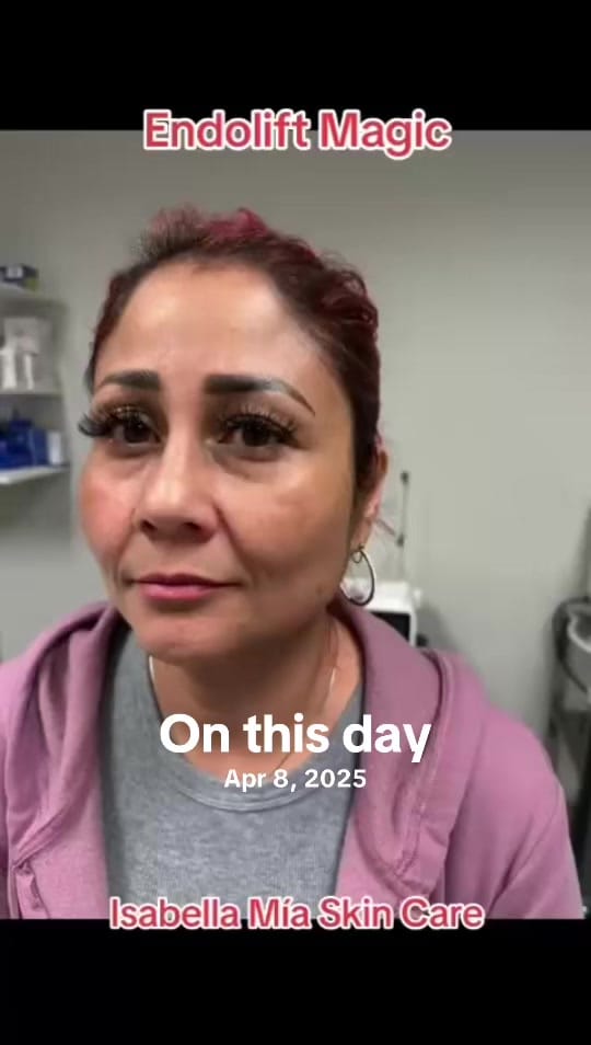 Post 1 by Isabella Mia Skin Care Houston on TikTok (video)