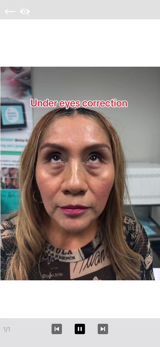 Post 3 by Isabella Mia Skin Care Houston on TikTok (video)