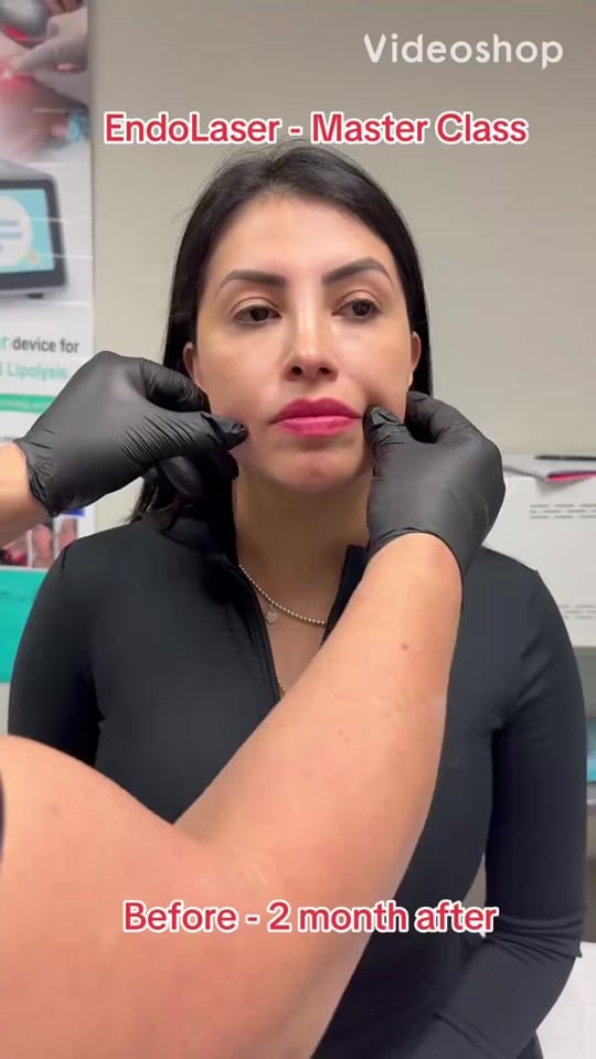 Post 6 by Isabella Mia Skin Care Houston on TikTok (video)