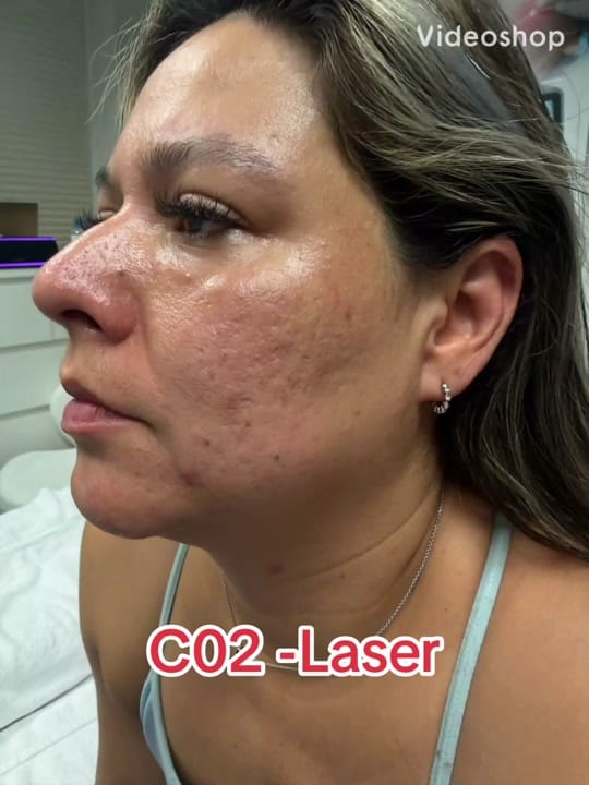 Post 10 by Isabella Mia Skin Care Houston on TikTok (video)