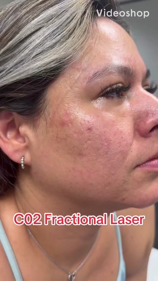 Post 7 by Isabella Mia Skin Care Houston on TikTok (video)