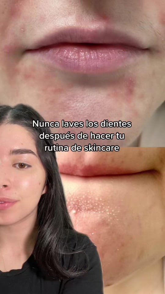 Post 9 by Fio on TikTok (video)