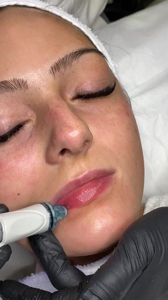 Post 9 by SkinrejuvAesthetics on TikTok (video)