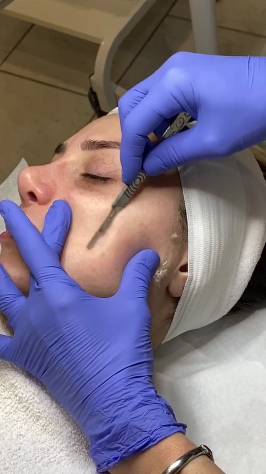Post 10 by SkinrejuvAesthetics on TikTok (video)