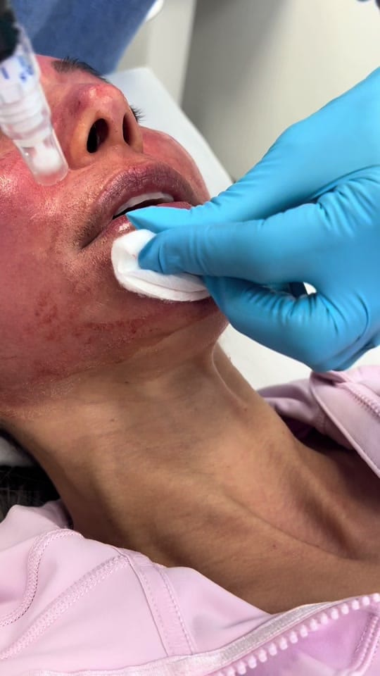 Post 4 by SkinrejuvAesthetics on TikTok (video)