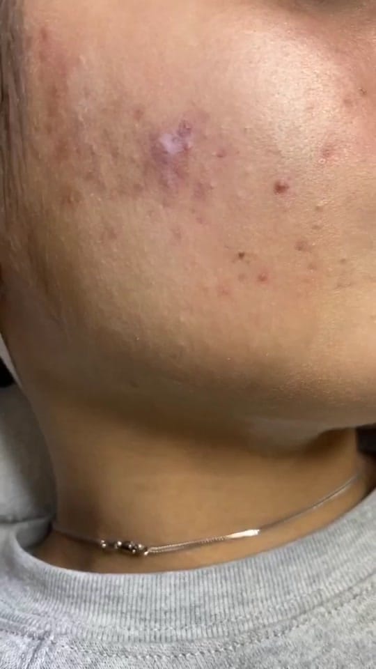 Post 8 by SkinrejuvAesthetics on TikTok (video)