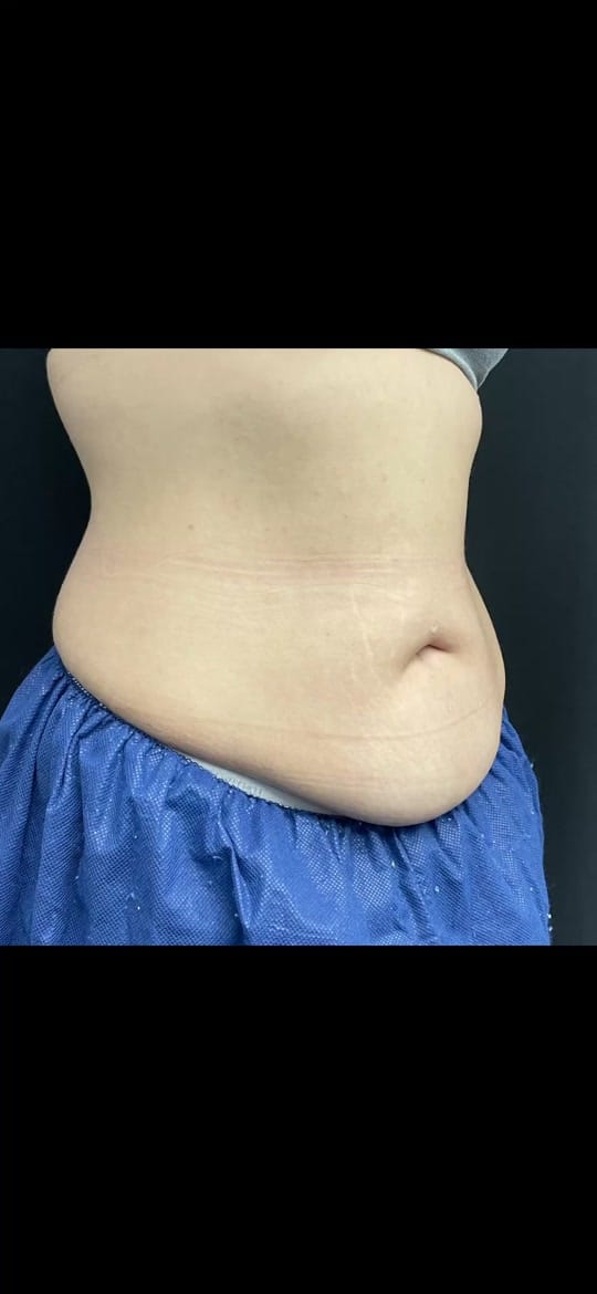 Post 7 by SkinrejuvAesthetics on TikTok (video)