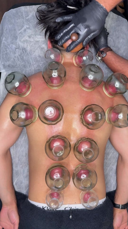 Post 3 by Hijama Berlin | الحجامة برلين on TikTok (video)