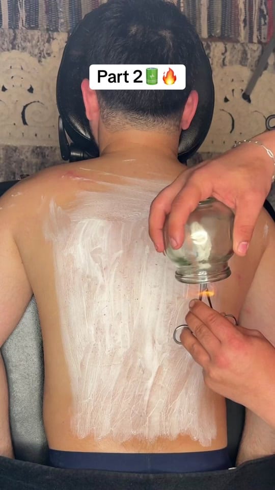 Post 2 by Hijama Berlin | الحجامة برلين on TikTok (video)