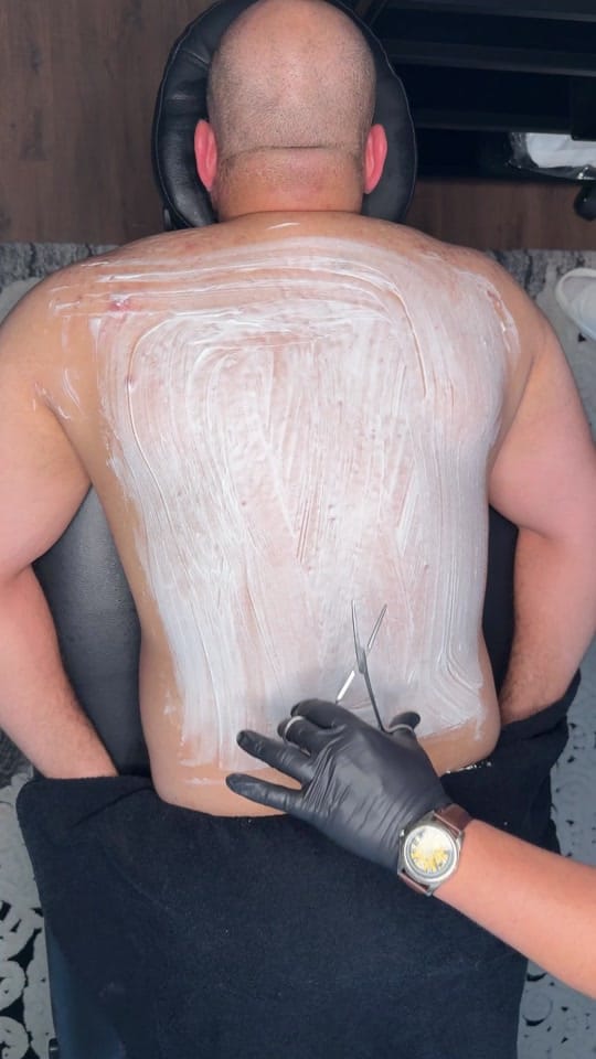 Post 6 by Hijama Berlin | الحجامة برلين on TikTok (video)