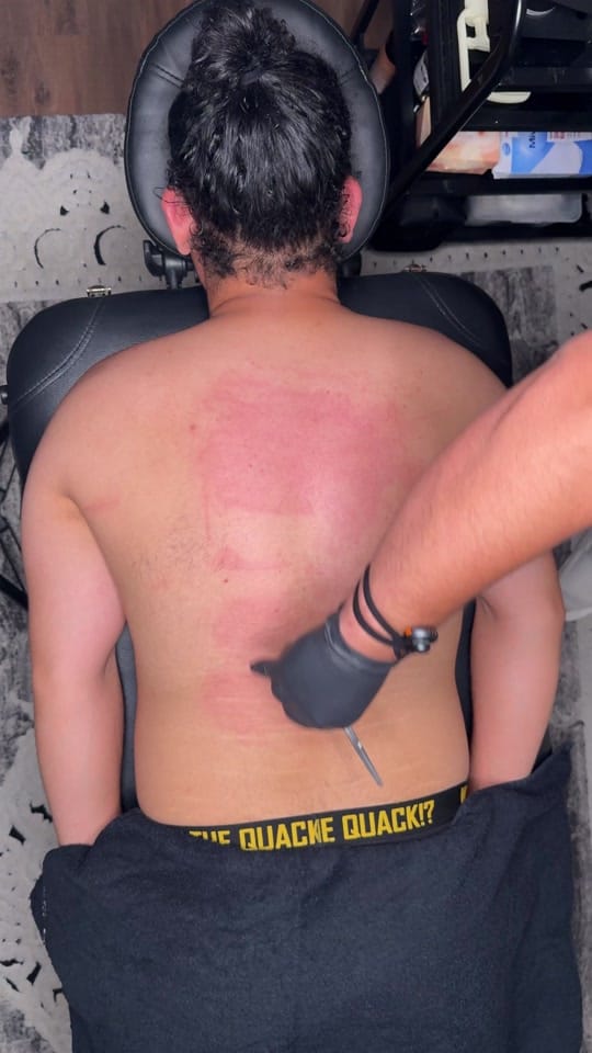 Post 8 by Hijama Berlin | الحجامة برلين on TikTok (video)