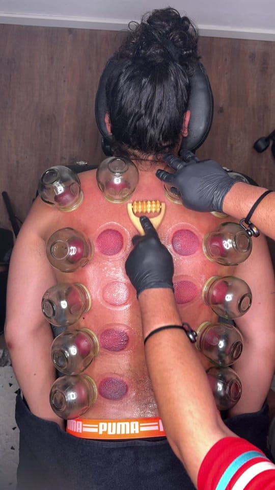 Post 5 by Hijama Berlin | الحجامة برلين on TikTok (video)