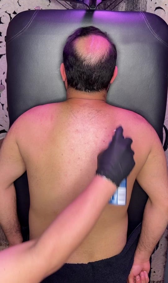 Post 10 by Hijama Berlin | الحجامة برلين on TikTok (video)