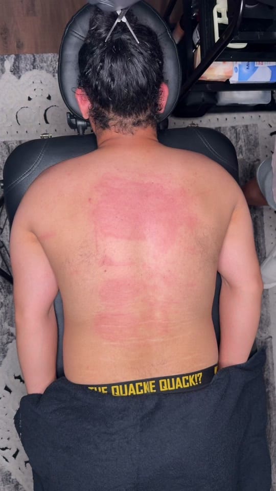 Post 9 by Hijama Berlin | الحجامة برلين on TikTok (video)